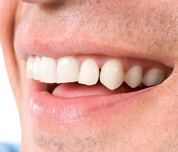 How important is your smile