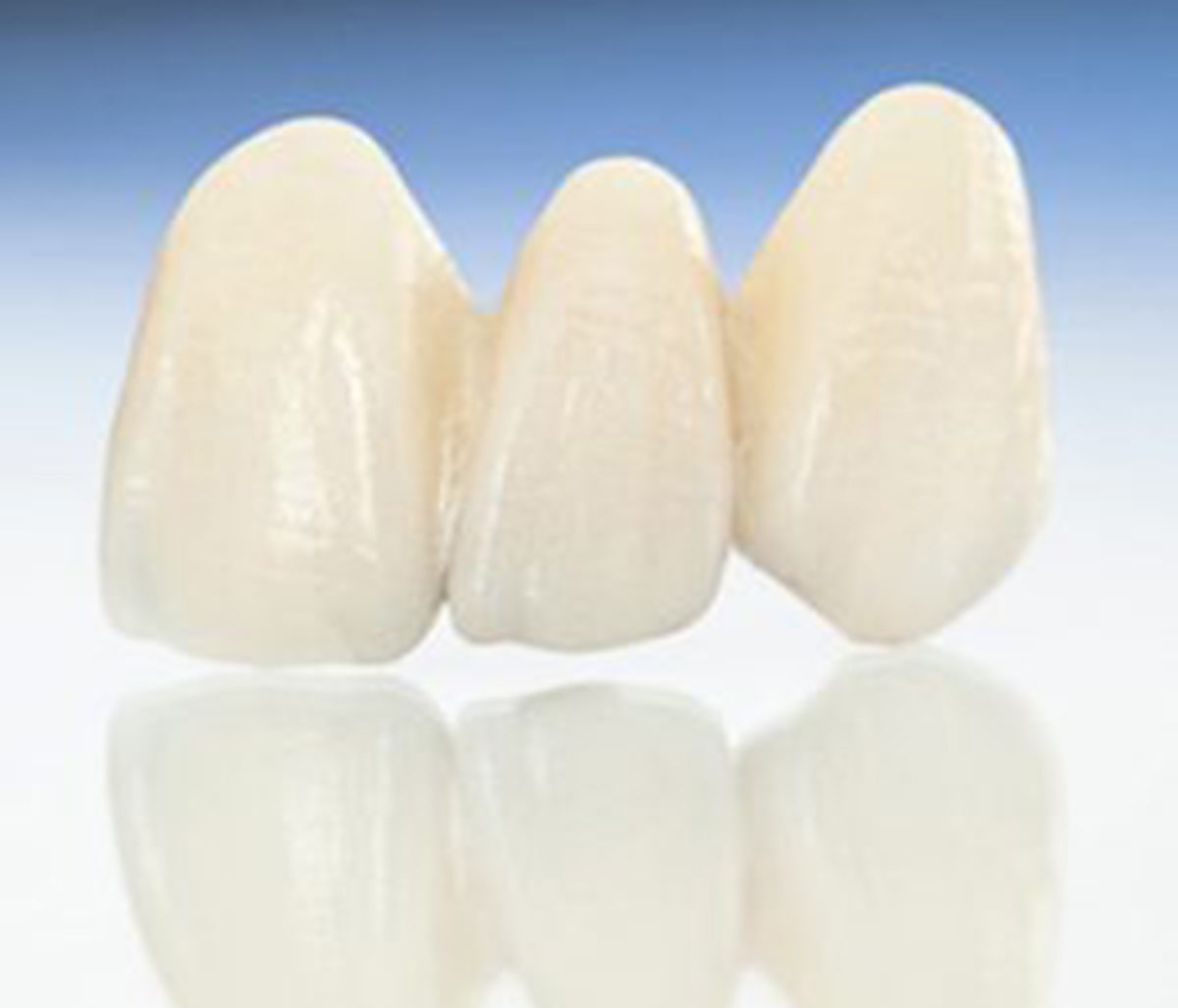 Dr Foncea How do Veneers Work?