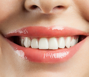 Beautiful smile with withe teeth