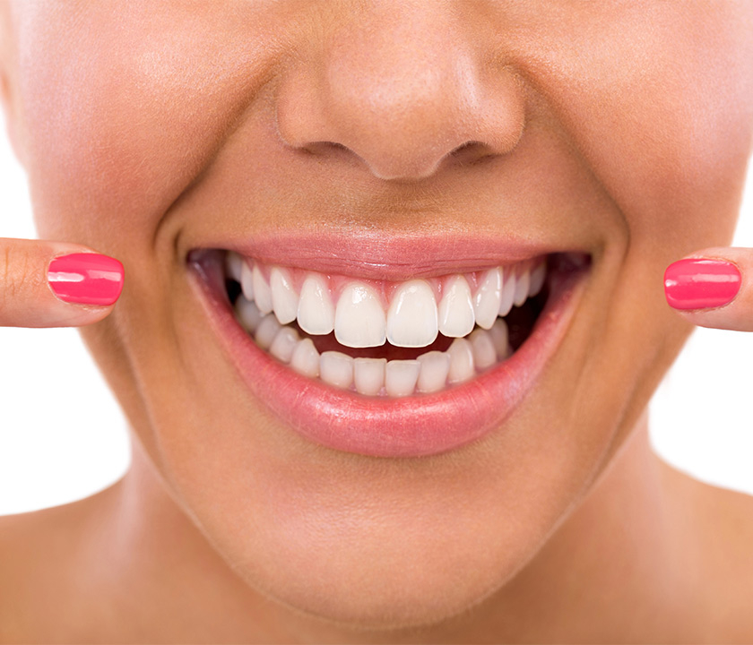 Why Choose Professional Whitening in Knoxville TN Area